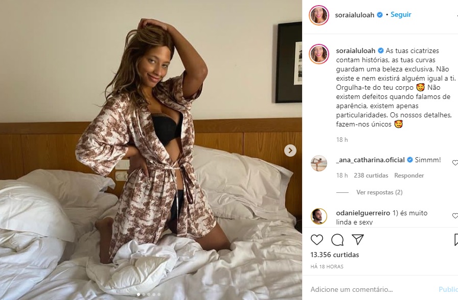 Soraia Do Big Brother Mostra Se Em Lingerie As Tuas Cicatrizes Contam Hist Rias